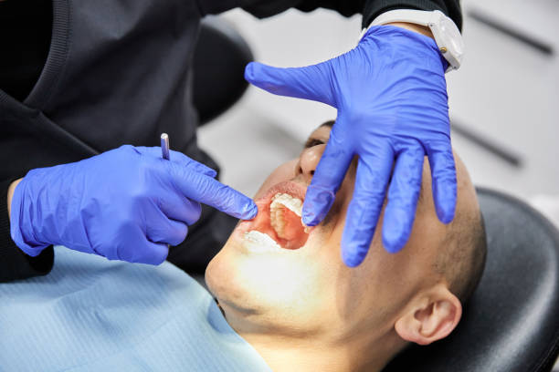 Best Emergency Broken Tooth Repair in USA